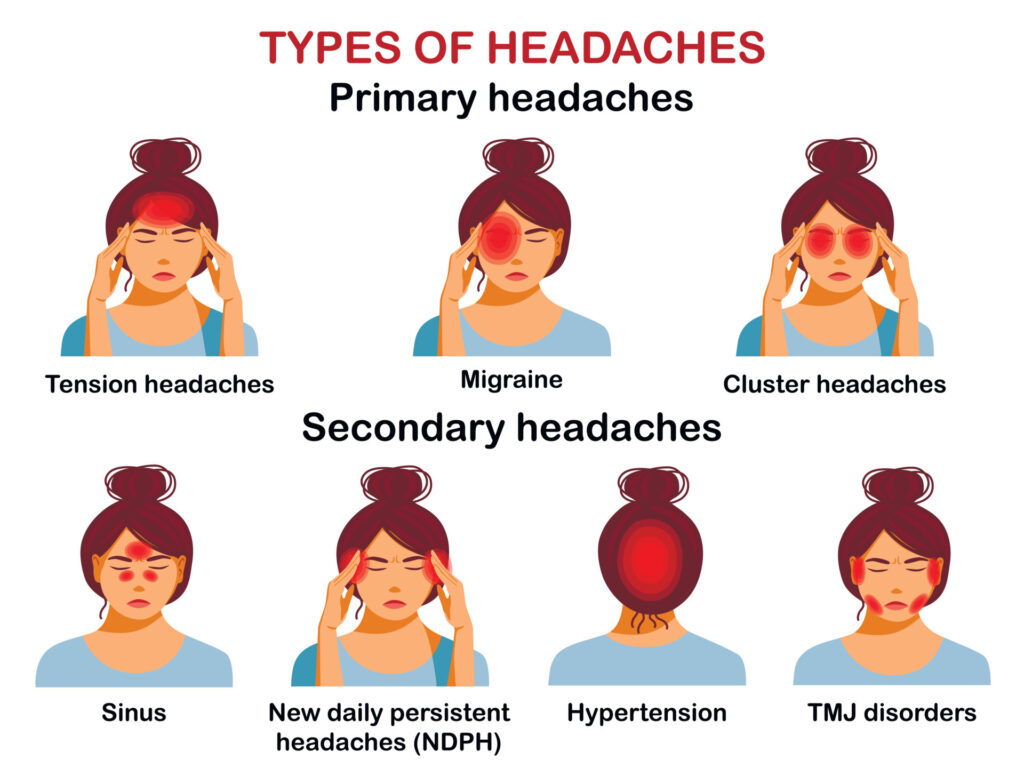 14 Types of Headaches